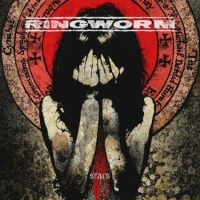 ringworm_scars